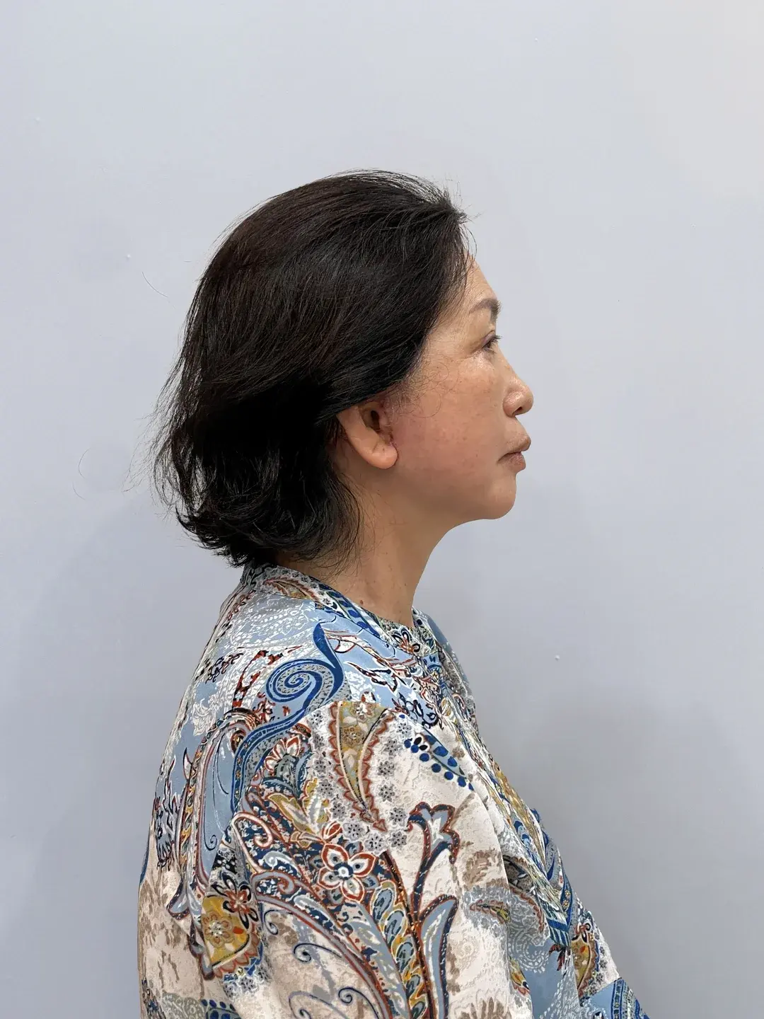 Apgujeong Seoul Plastic Surgery — 3