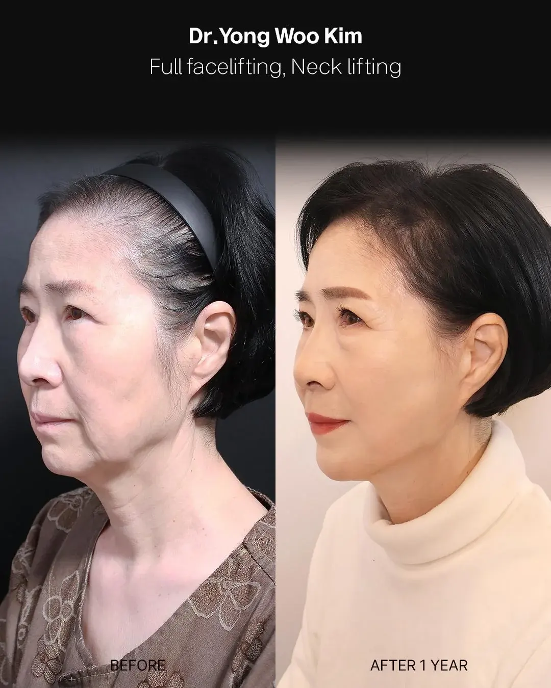 RETURNING Plastic Surgery — 2