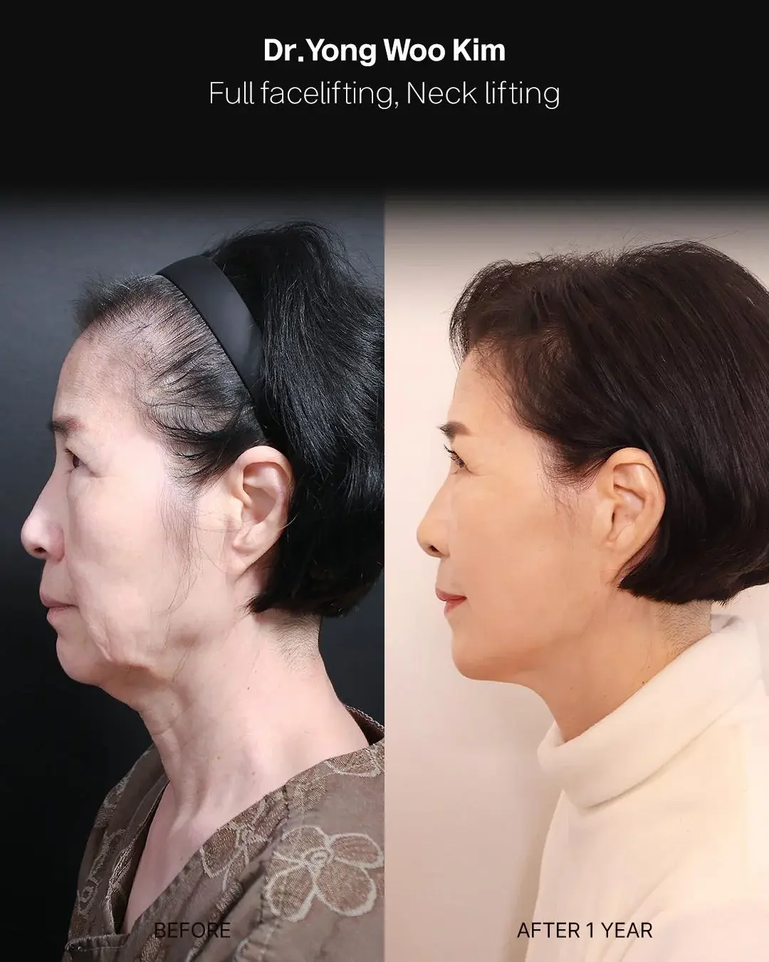 RETURNING Plastic Surgery — 3