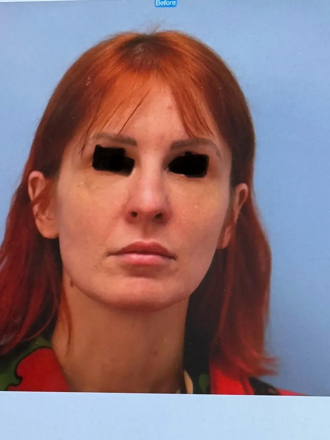 THE PLAN Plastic Surgery — 1