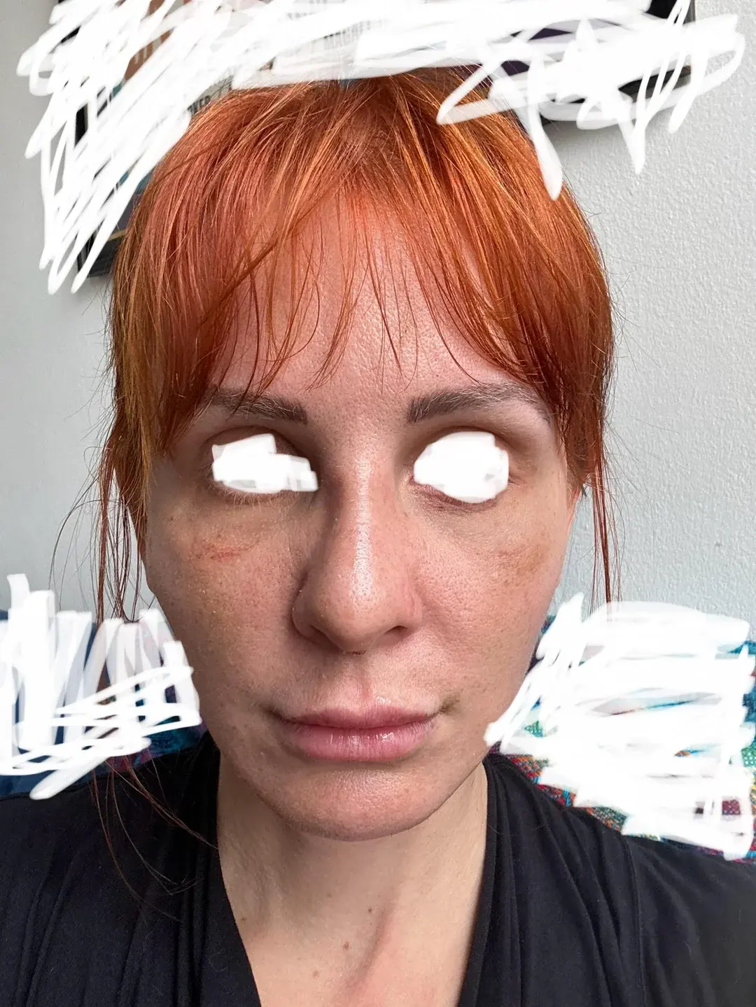 THE PLAN Plastic Surgery — 11