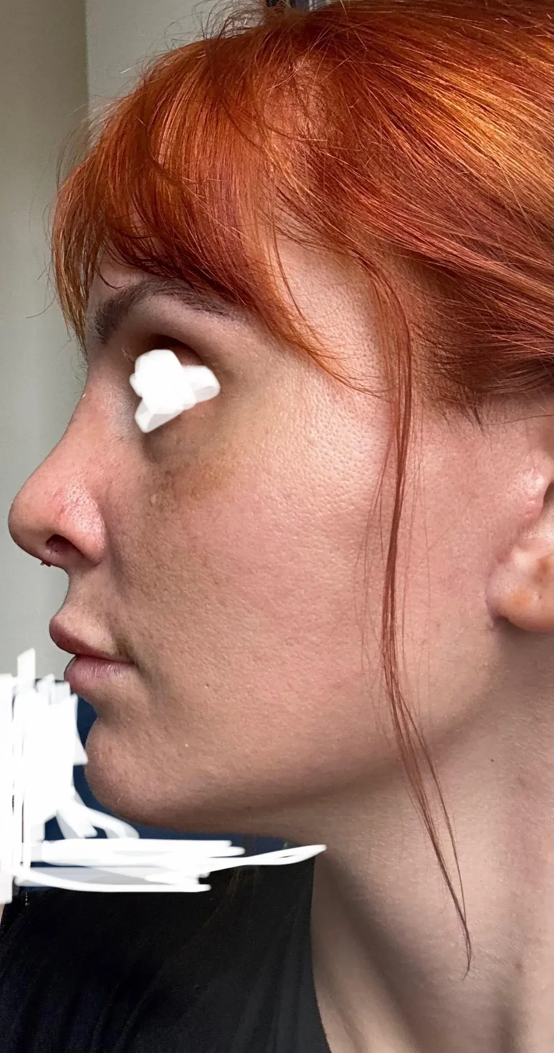 THE PLAN Plastic Surgery — 12