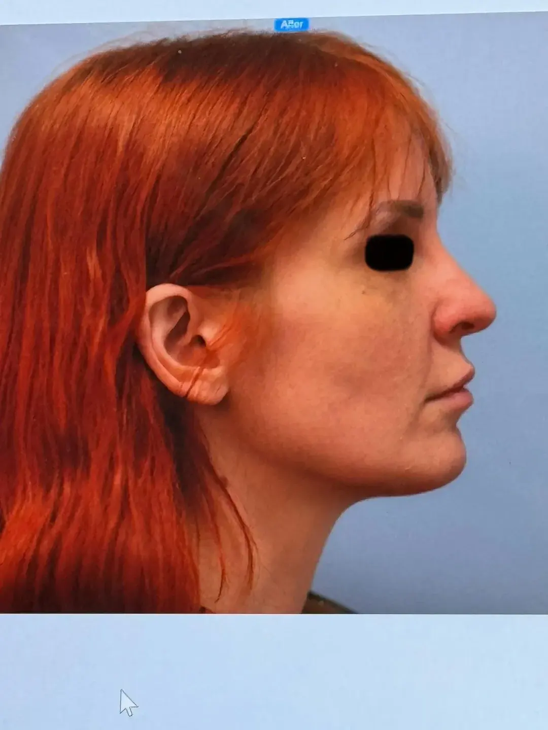 THE PLAN Plastic Surgery — 2