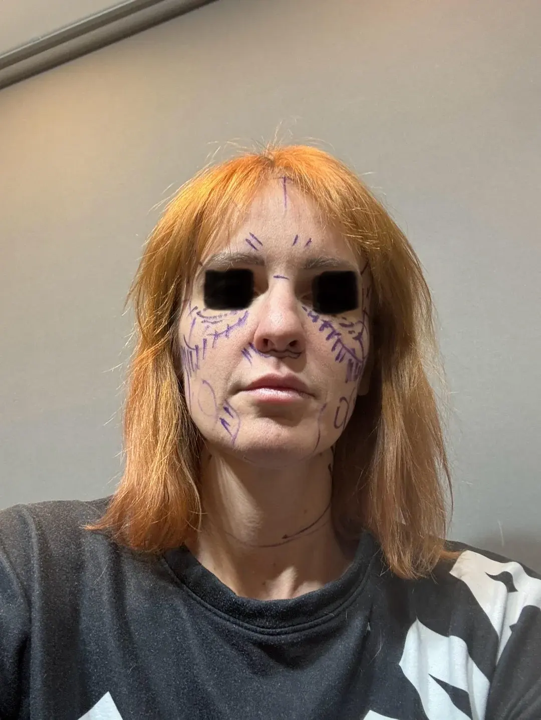 THE PLAN Plastic Surgery — 3