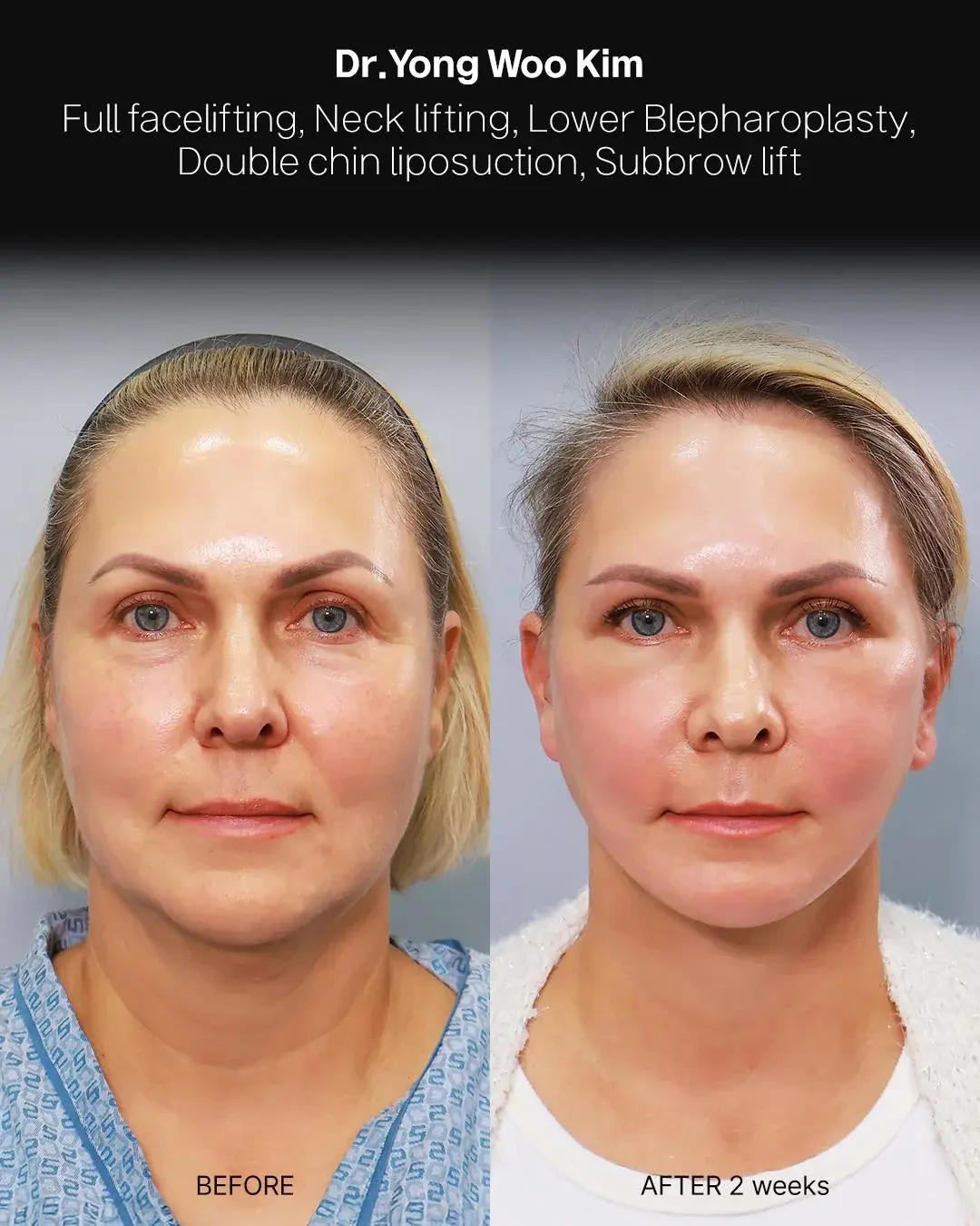 RETURNING Plastic Surgery — 1