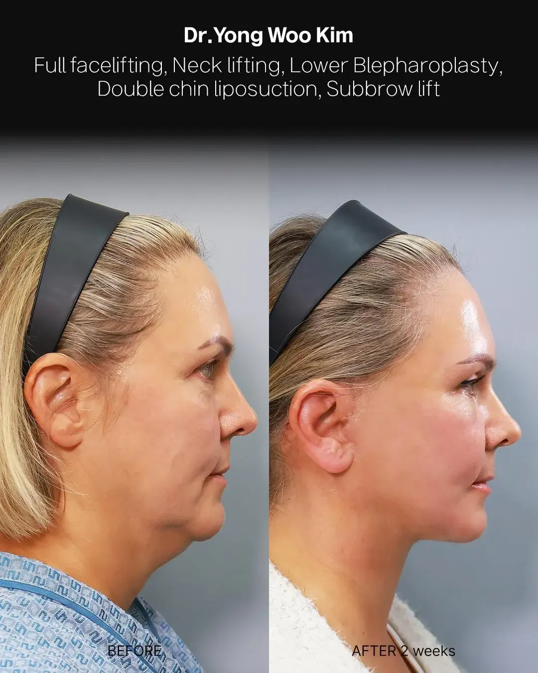 RETURNING Plastic Surgery — 3