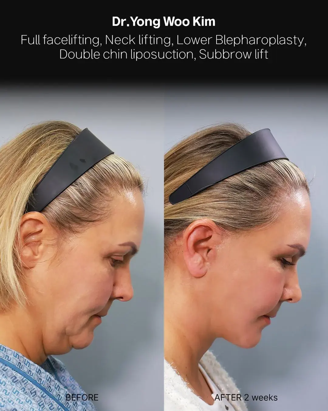 RETURNING Plastic Surgery — 4