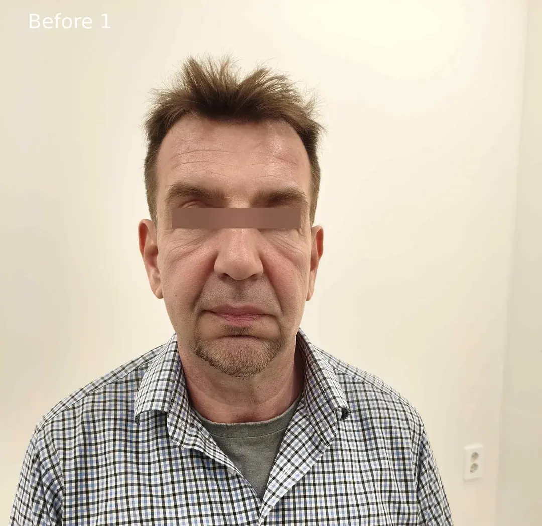 Dasipium Plastic Surgery — 1