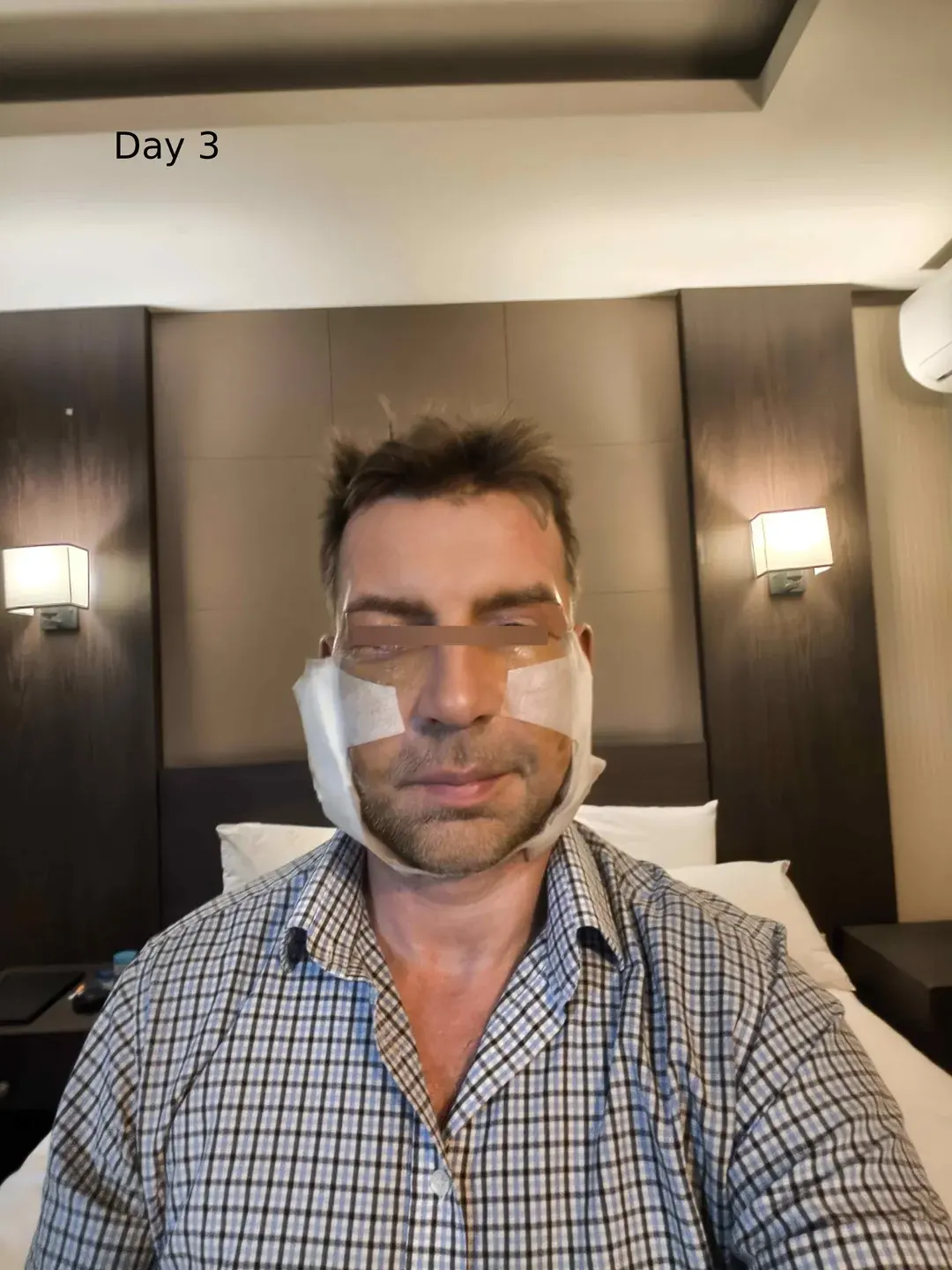 Dasipium Plastic Surgery — 3