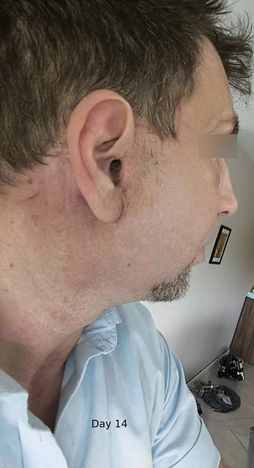 Dasipium Plastic Surgery — 5