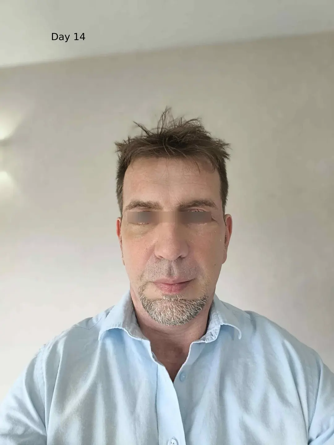 Dasipium Plastic Surgery — 6
