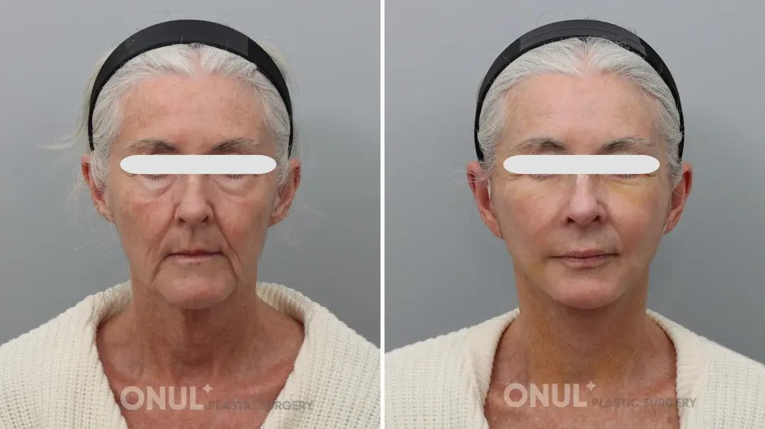 ONUL Plastic Surgery — 1