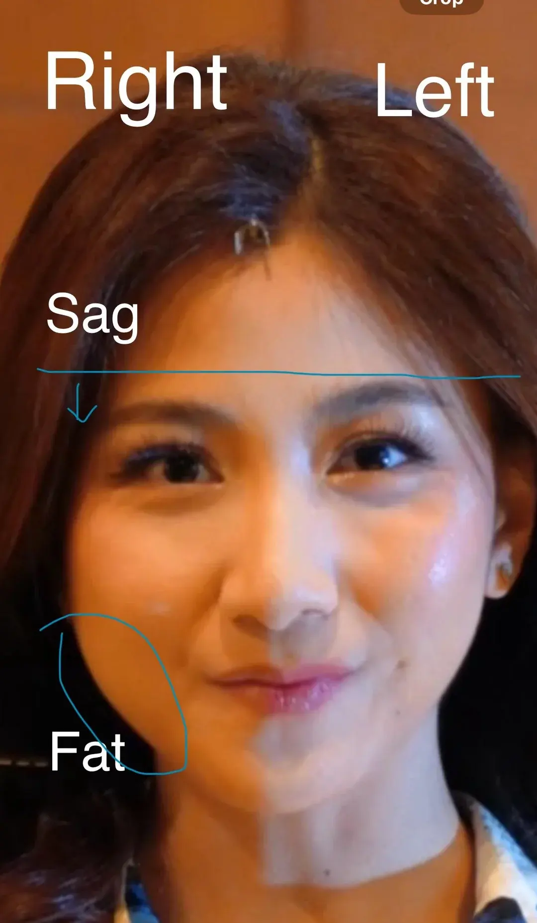 VIEW Plastic Surgery — 2