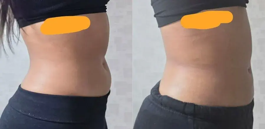 EYEFIT Plastic Surgery — 1