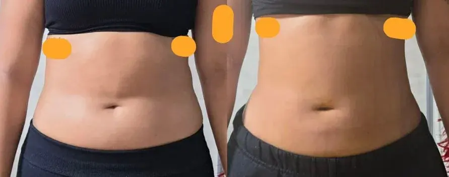 EYEFIT Plastic Surgery — 2