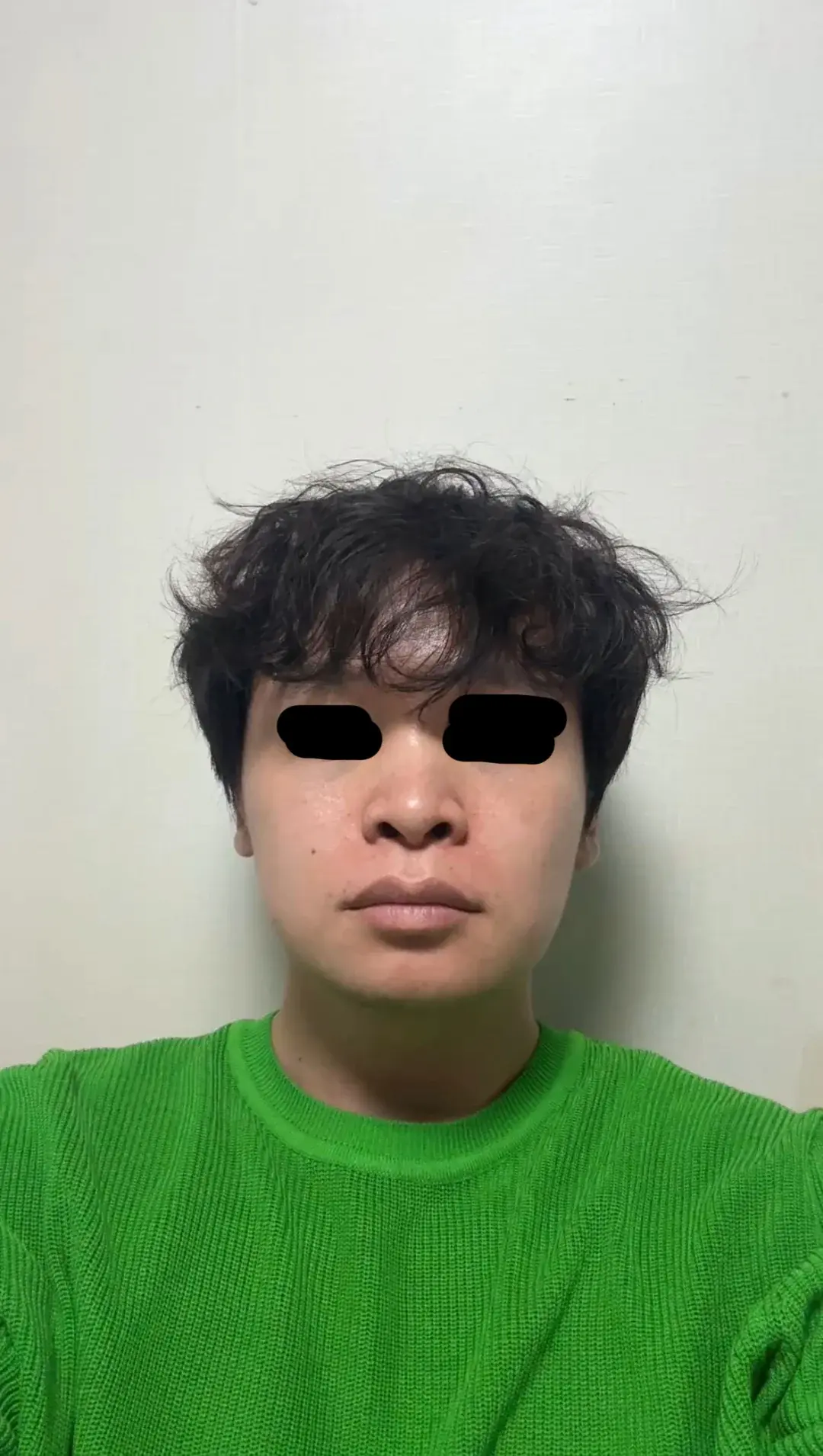 BT Plastic Surgery — 1