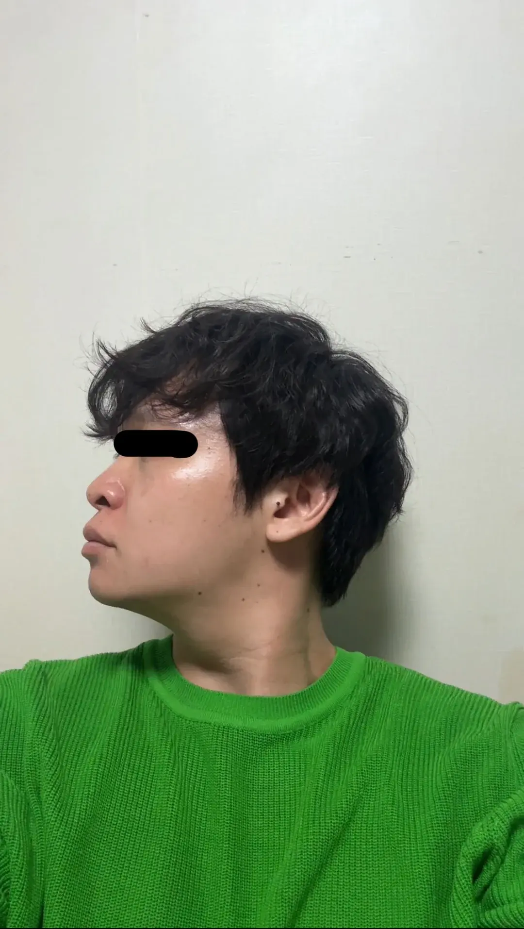 BT Plastic Surgery — 2