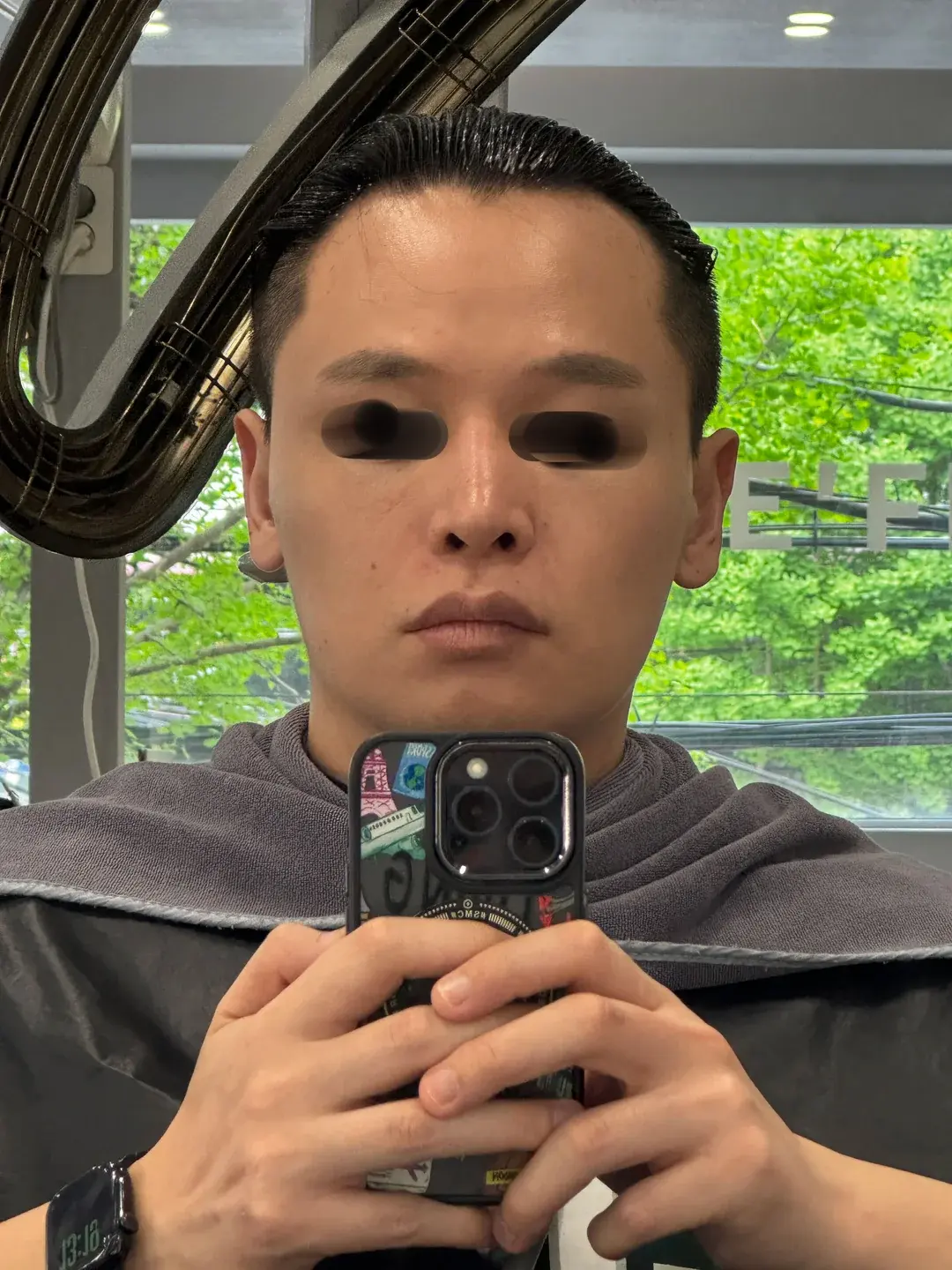 BT Plastic Surgery — 6