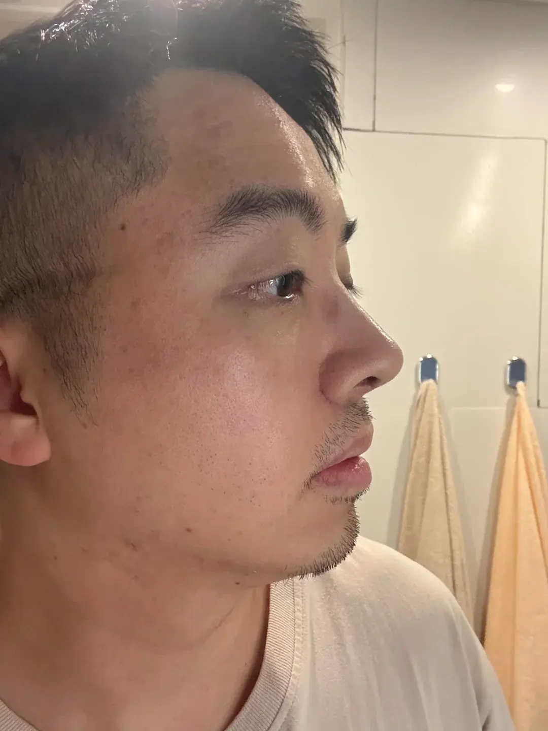 Wink Plastic Surgery — 4