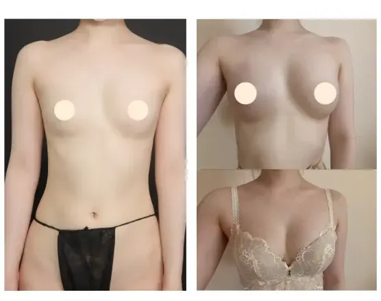 Marble Plastic Surgery — 1