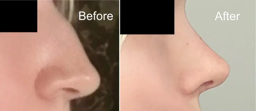 AB Plastic Surgery — 1