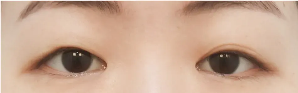 SUGAR Plastic Surgery — 1