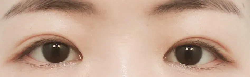 SUGAR Plastic Surgery — 2