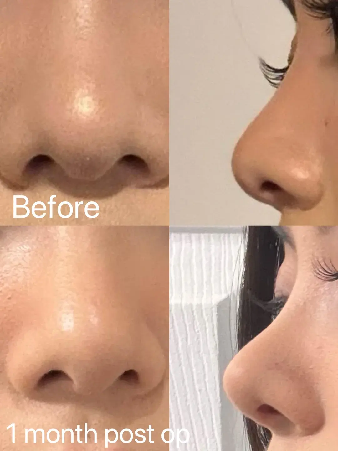 MOOi Plastic Surgery — 1