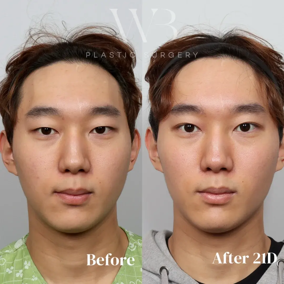 Woori Plastic Surgery Clinic — 1