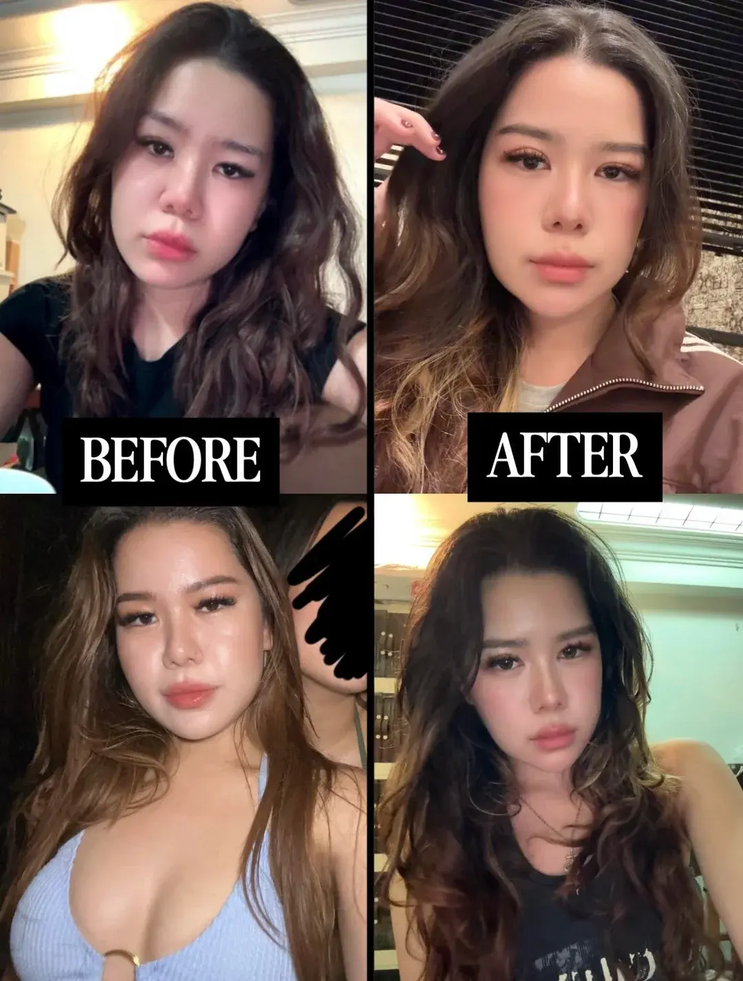 Woori Plastic Surgery Clinic — 1