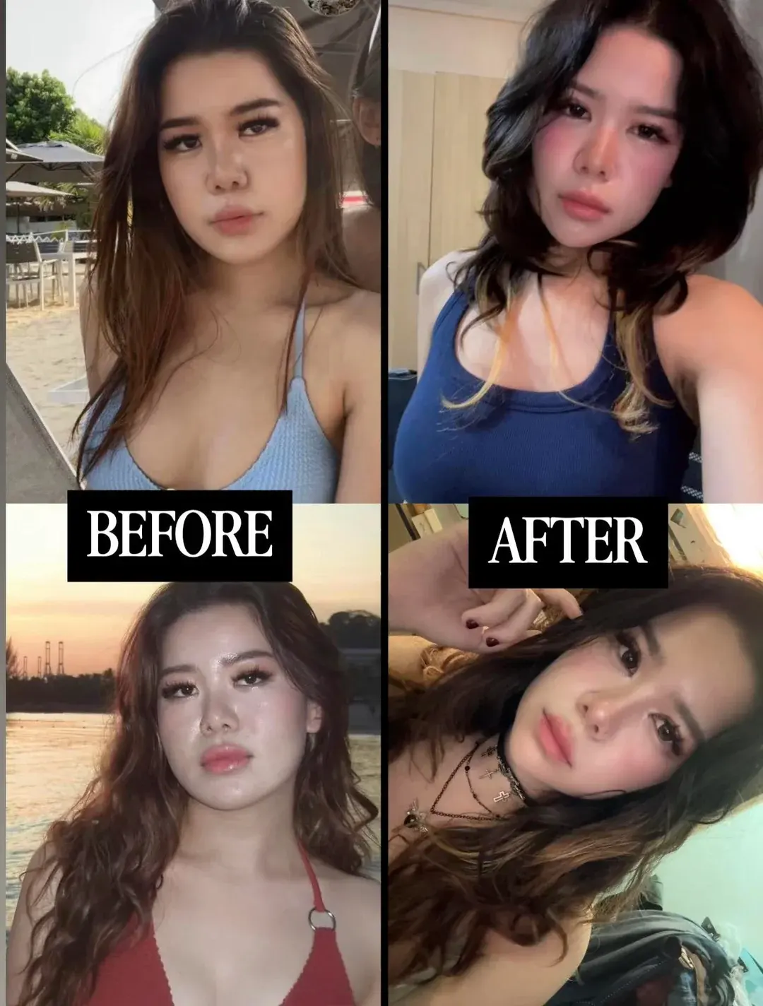 Woori Plastic Surgery Clinic — 2