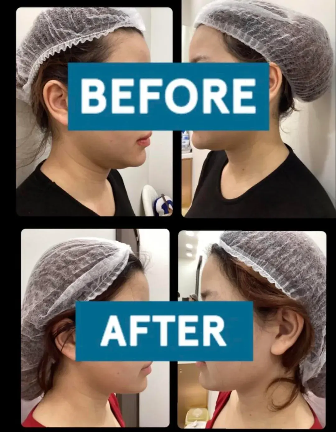 Woori Plastic Surgery Clinic — 4