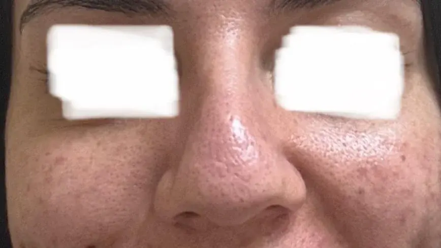 SUGAR Plastic Surgery — 1
