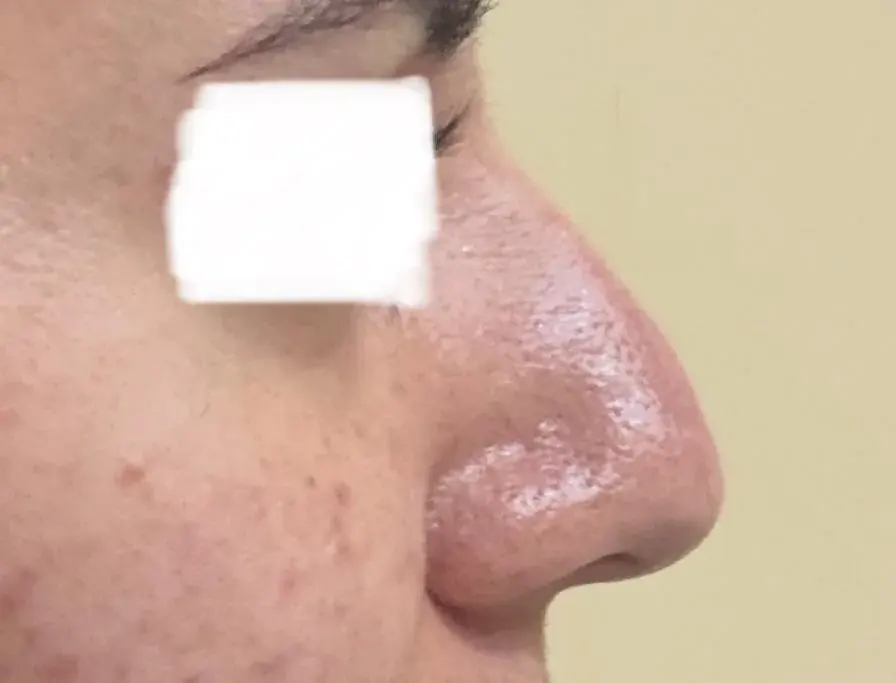 SUGAR Plastic Surgery — 2