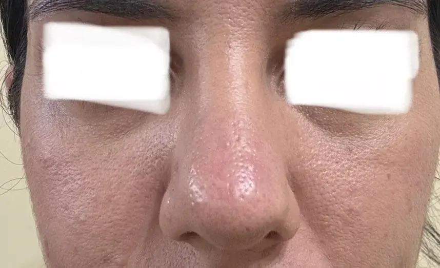 SUGAR Plastic Surgery — 3
