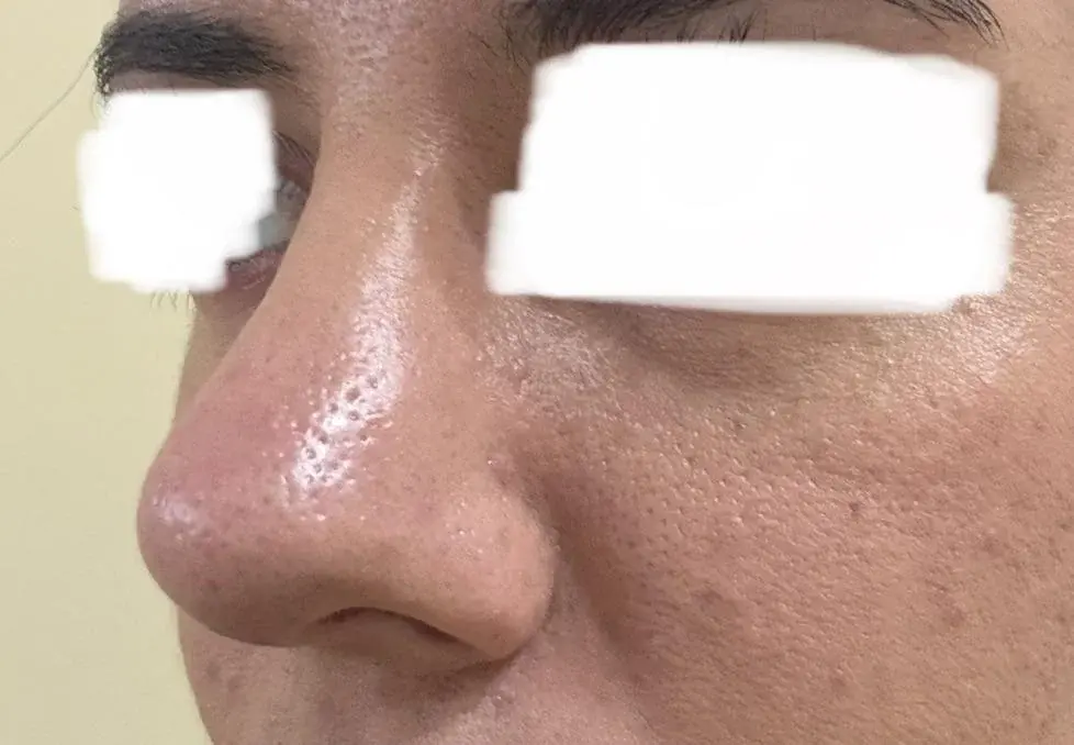 SUGAR Plastic Surgery — 4