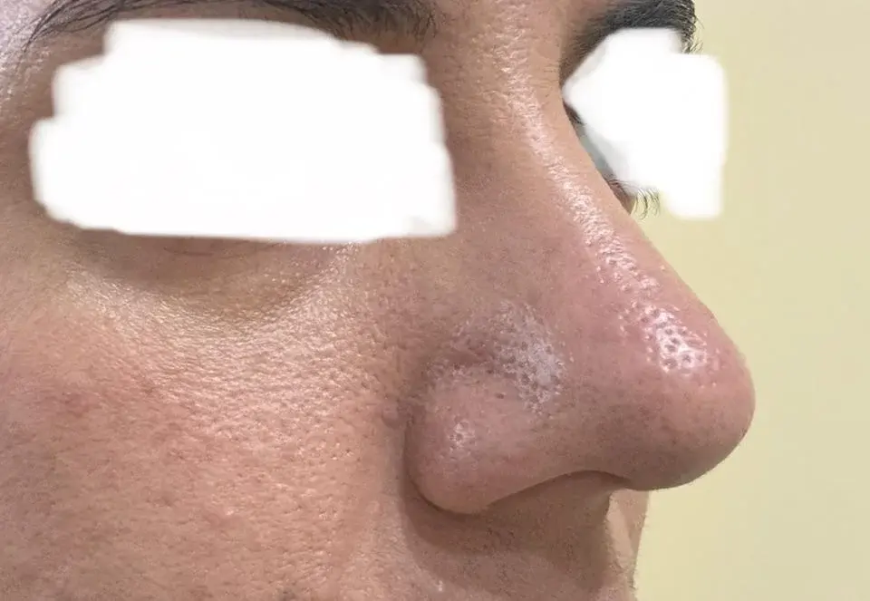 SUGAR Plastic Surgery — 5