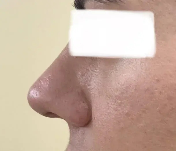 SUGAR Plastic Surgery — 6