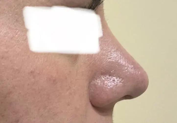SUGAR Plastic Surgery — 7