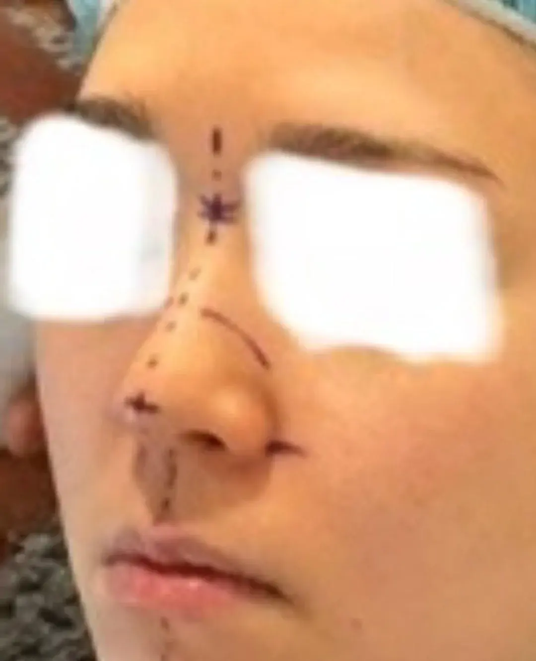 I'M Plastic Surgery — 1