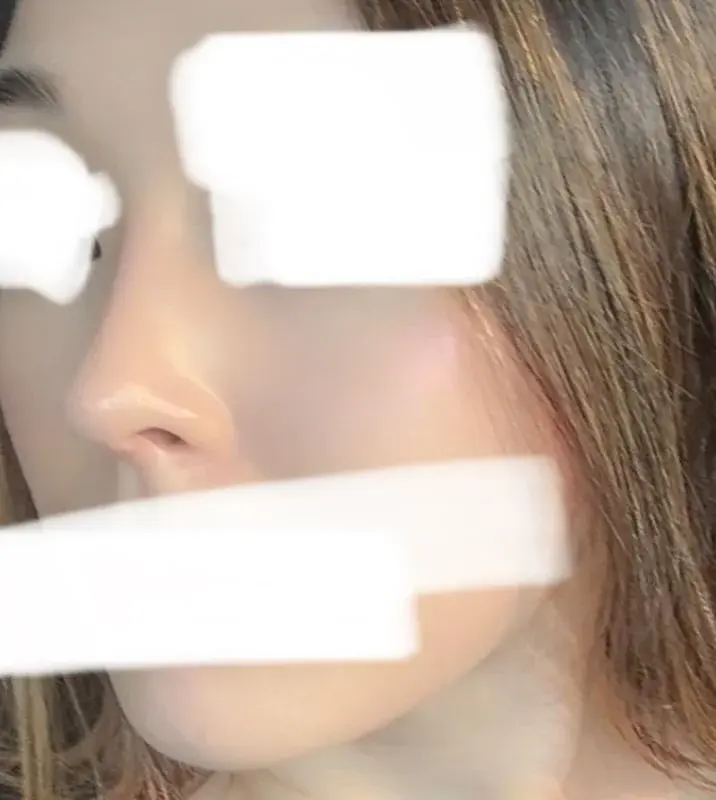 I'M Plastic Surgery — 2