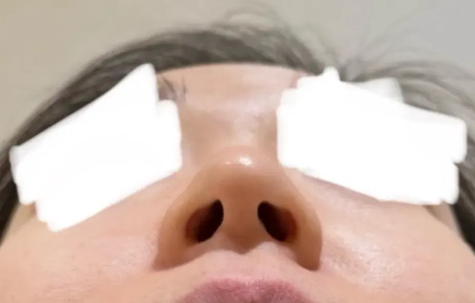 I'M Plastic Surgery — 3