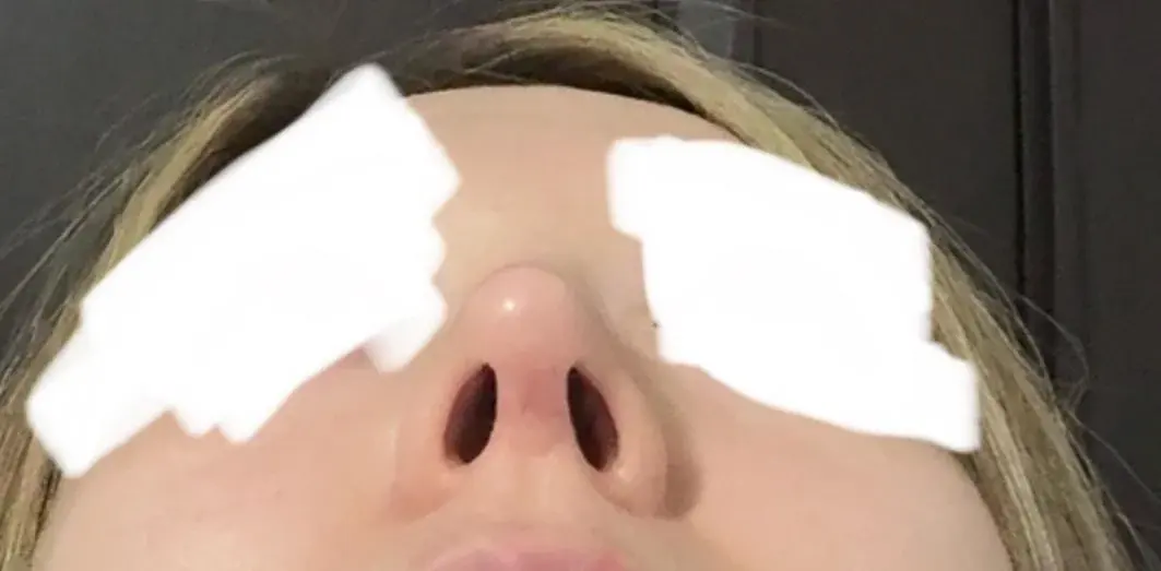 I'M Plastic Surgery — 4