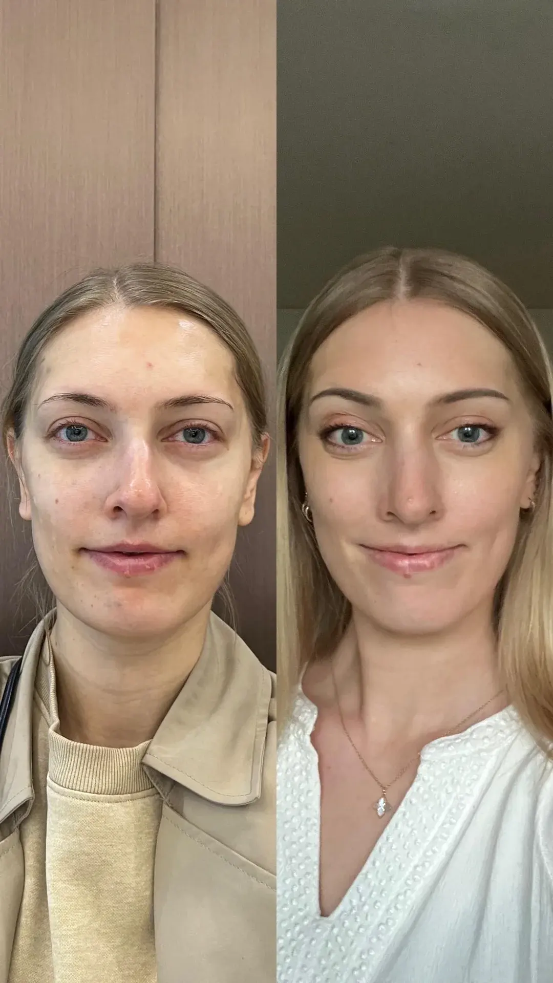 Urban Plastic Surgery — 1