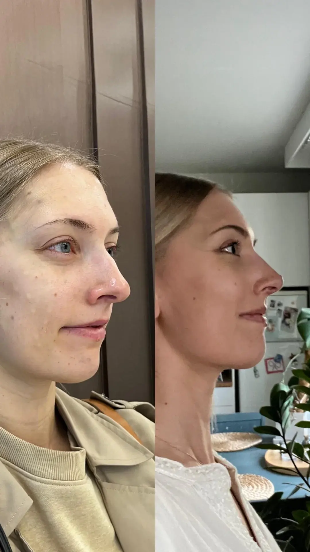 Urban Plastic Surgery — 2