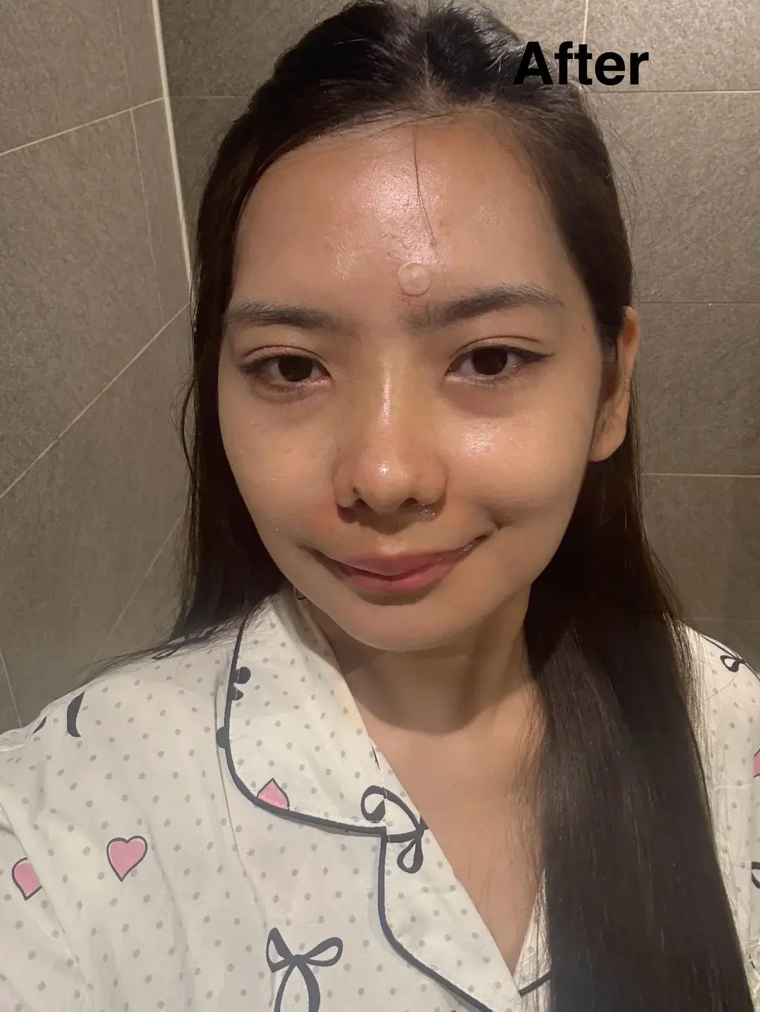 BRAUN Plastic Surgery — 3