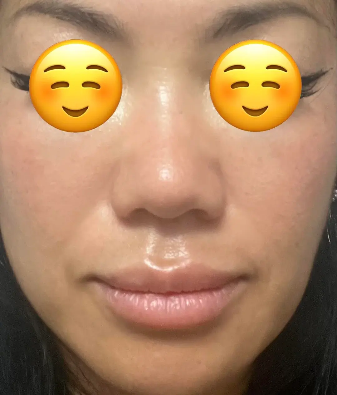 KOWON Plastic Surgery — 2