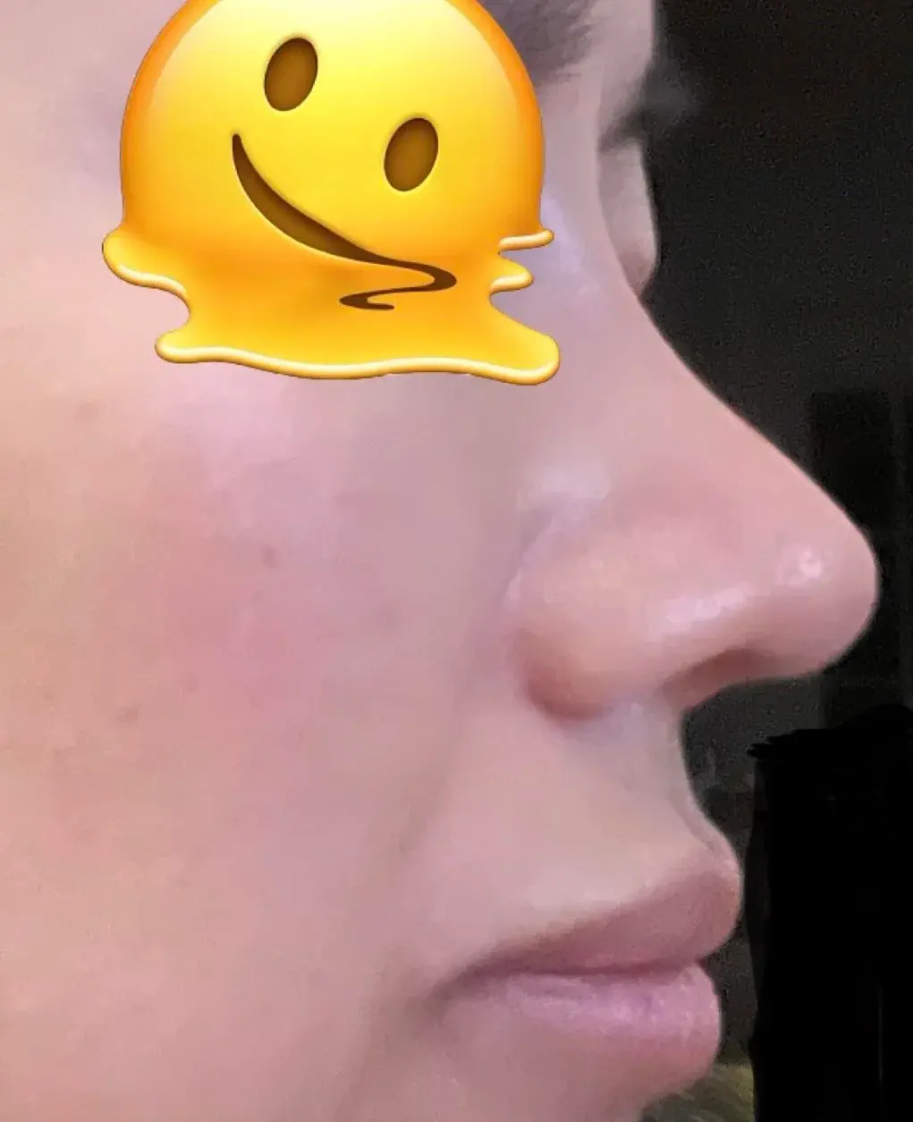 KOWON Plastic Surgery — 3