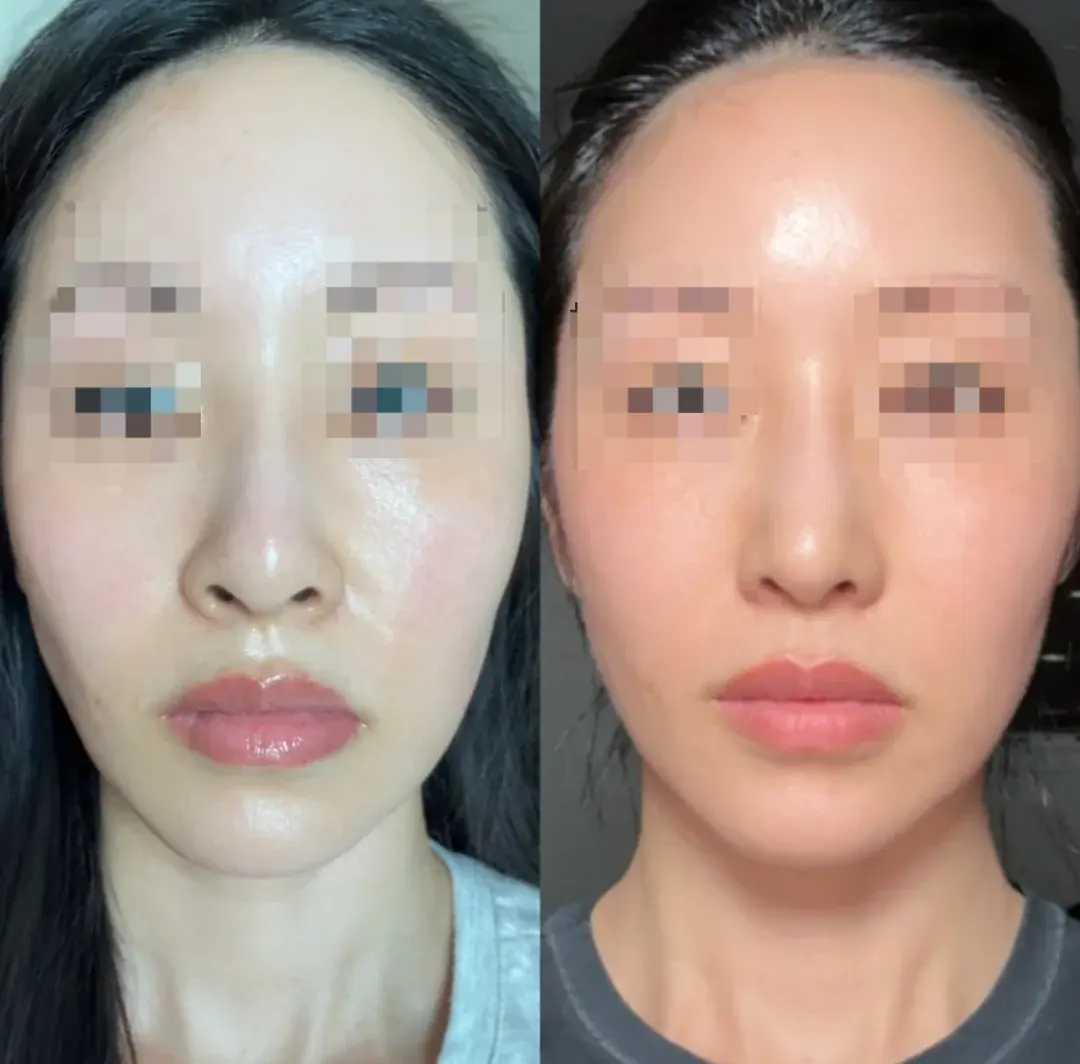 RISE Plastic Surgery — 1