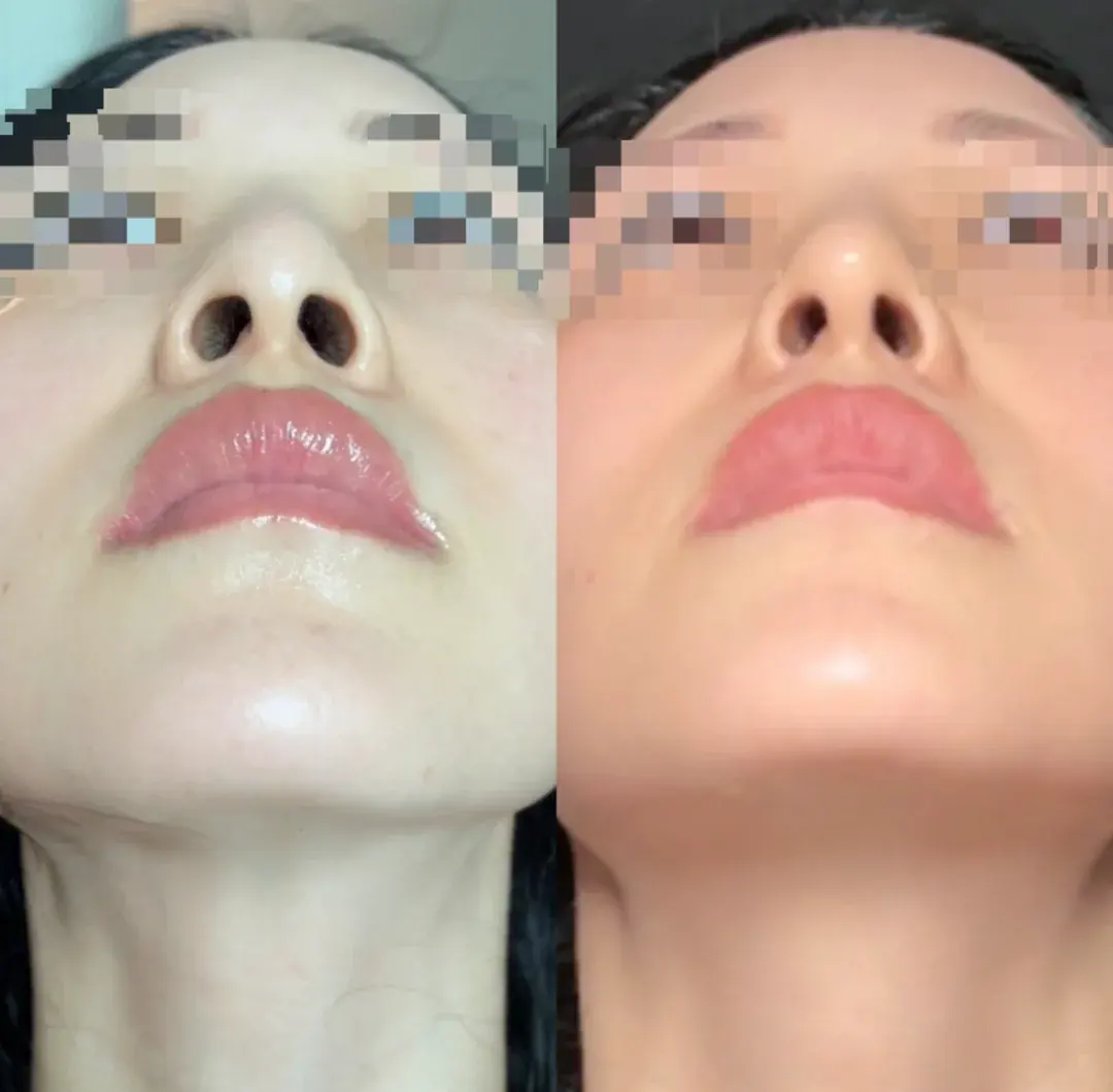 RISE Plastic Surgery — 2